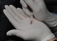 Analyzing DNA from a skin sample collected using a biopsy dart